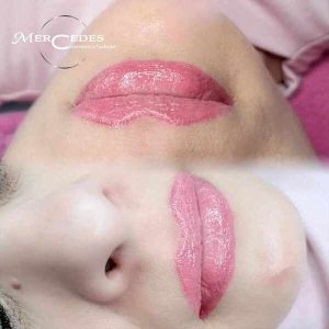 Gyógyult ajaktetoválás