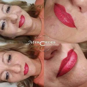 Gyógyult ajaktetoválás