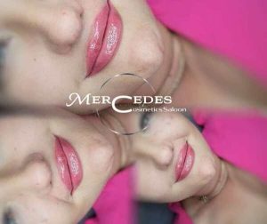 Gyógyult rúzsozott ajaktetoválás és ajakfeltöltés